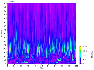 Gambar 16. WT dengan sensor piezoelektrik saat misalignment 