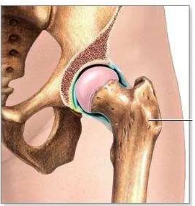 Gambar 2.3. Hip joint yang normal [4]. 