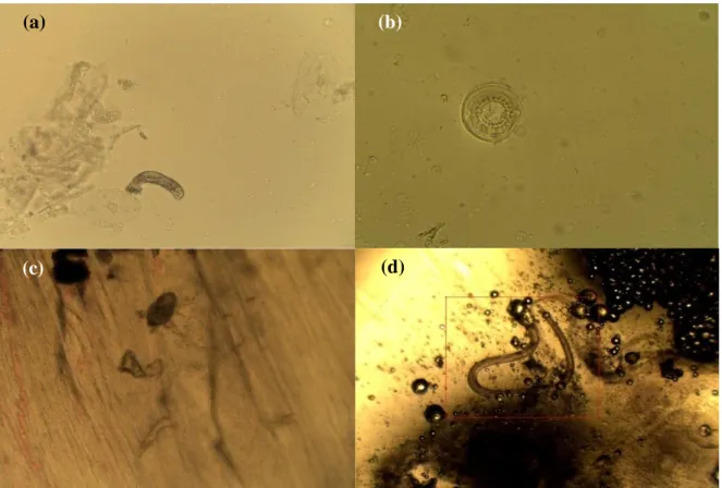 Gambar 2. Jenis-jenis parasit yang ditemukan pada ikan betok Anabas testudineus       (a)  Dactylogyrus sp., (b) Trichodina sp., (c) Argulus sp., (d) Camallanus sp
