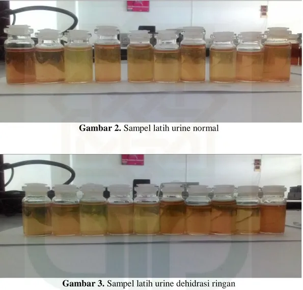 Gambar Sampel Latih Urine Normal, Urine Dehidrasi Ringan, dan Urine  Dehidrasi Berat 