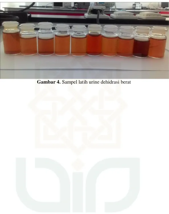 Gambar 4. Sampel latih urine dehidrasi berat 
