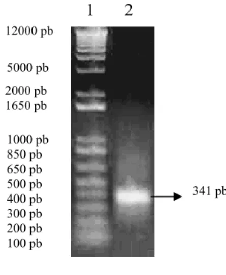 Gambar 7. Pita hasil PCR cDNA   Keterangan :  