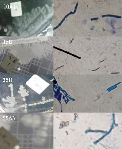 Gambar  3.(A)  Morfologi  koloni  dan  (B)  morfologi  sel  bakteri  pembentuk  biofilm  pada  aplikasi  klor  aktif  10  ppm  (10A1),  15  ppm  (15B1),  25  ppm  (25B1),  dan  55  ppm  (55A3)