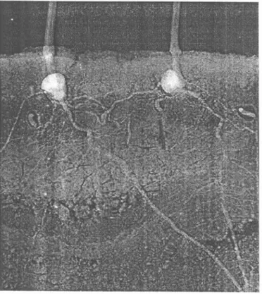 Gambar 14. Radiografneutron bijijagung yang bam tumbuh dengan hama uret di sekitar akarnya