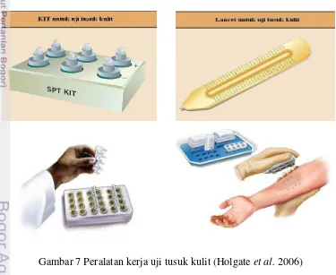 Gambar 7 Peralatan kerja uji tusuk kulit (Holgate et al. 2006) 