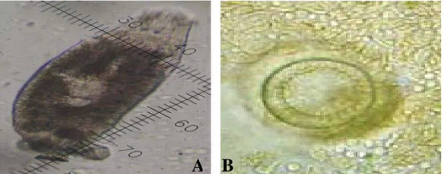 Gambar 2. Jenis-jenis ektoparasit pada kerapu macan 10 x 40                       (A. Diplectanum; B