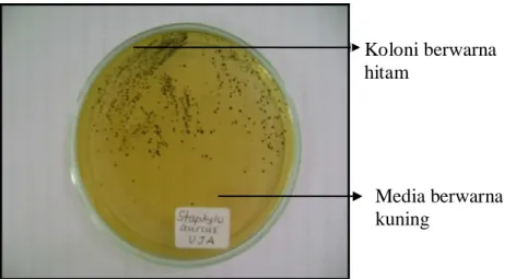 Gambar 1. Staphylococcus aureus dalam medium VJA. 