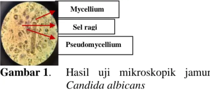 Gambar 1.  Hasil  uji  mikroskopik  jamur  Candida albicans 