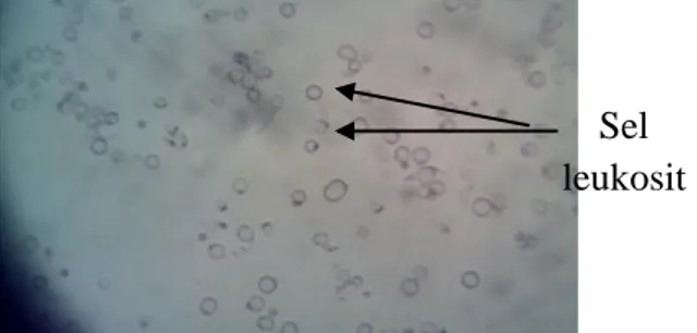 Gambar 7. Sel leukosit mencit dilihat menggunakan dengan  hemocytometer pada  pembesaran 