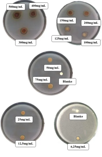 Gambar hasil uji aktivitas  antibakteri ekstrak etanol  daun jambu bol terhadap bakteri Pseudomonas aeroginosa   