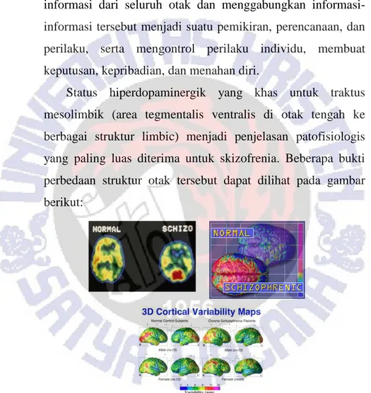 Gambar 2.1 Perbedaan struktur otak penderita skizofrenia dan yang 
