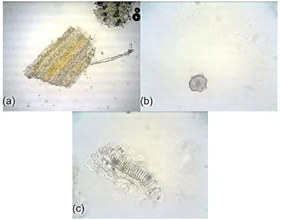 Figure 1.  Microscopic examination crude drug of J. multifida L. in chloral hidrate, (a) parenchyma (100x), (b) crystal (400x), (c) tracheid (400x)