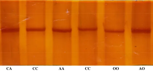 Gambar 1. Visualisasi pola pita gen β-kasein pada gel poliakrilamida 10% dengan metode PCR-SSCP 