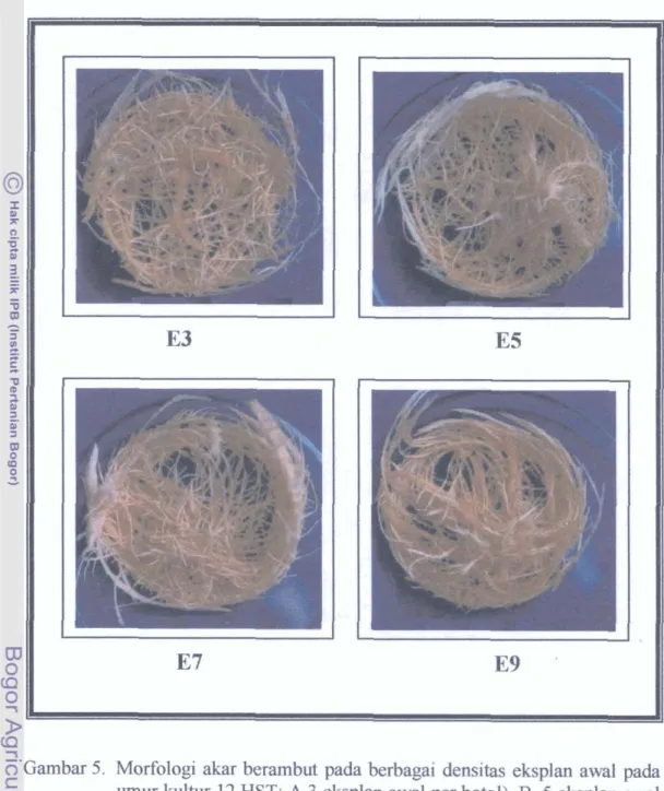 Gambar 5.  Morfologi akar berambut pada berbagai  densitas eksplan  awal  pada  umur kultur 12 HST:  A.3  eksplan awal per botol),  B