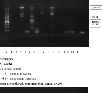 Gambar 4.1 Hasil Elektroforesis Mammaglobin (sampel 1-14) 