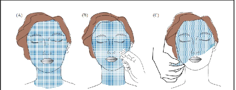 Gambar 2.4. Cara Menggunakan Masker GelPeel Off  (Shai et al., 2009)  Keterangan:  (A)  Sepotong  kain  kasa  yang  dibasahi  dengan  air  ditempatkan  pada 