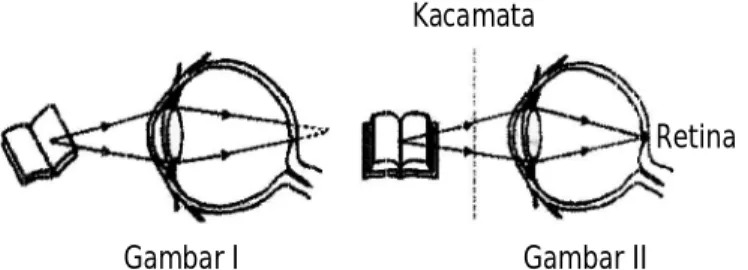 Gambar I  Gambar II 