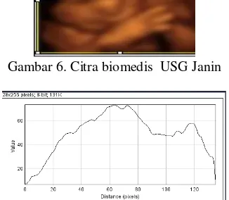 Gambar 7. Grafik Rata-Rata Citra biomedis  USG 