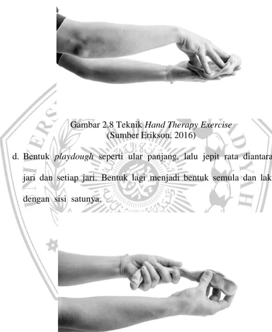Gambar 2.8 Teknik Hand Therapy Exercise  (Sumber Erikson, 2016) 