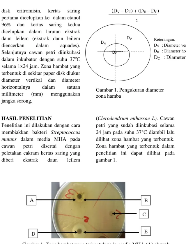 Gambar 1. Pengukuran diameter  zona hamba