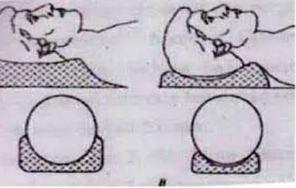 Gambar 2.6  Bantalan Kepala  dan Leher  (Bentel G.C 1996) 