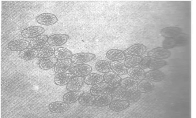 Gambar 1. Urediospora Phakopsora pachyrhizi Syd. penyebab penyakit karat  kedelai 300 x(dalam Anon.,1985) 