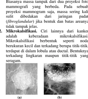 Gambar 2.2 Citra Mammogram (a)posisi cranio-caudal, (b)posisi medio-lateral oblique (citra pemberianUnitRadiologi RS Telogorejo, Semarang)