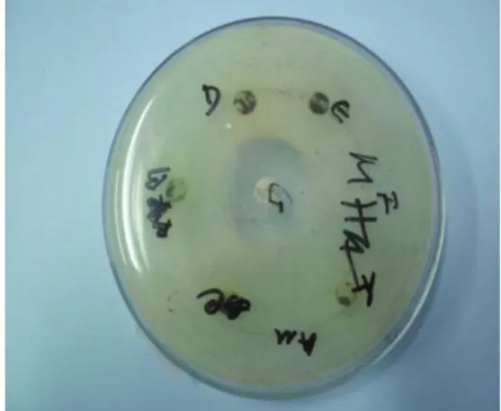 Gambar 3. Diameter zona hambat dari  ekstrak  daun  muda  sirsak  Annona  muricata L. urutan daun ke-2 terhadap 