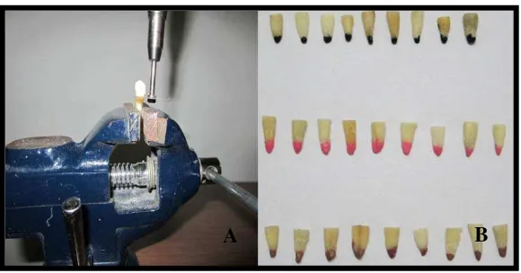 Gambar 7. A. Penanaman sampel akar gigi pada balok gips, B. Ekstirpasi saluran   akar dengan Barbed Broaches, C