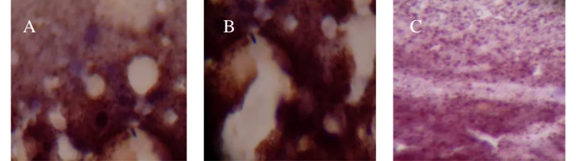 Gambar 6.  Foto  mikroskopis  perbesaran  100x10  sediaan  imunositokimia  SBPC  head  squash  nyamuk  Toxorrhynchites  sp  yang  disuntik  intratorakal  dengan  serum  pasien  positif  mengandung  virus Dengue memperlihatkan hasil positif berwarna coklat 