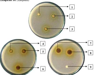 Gambar hasil uji aktivitas antibakteri fraksi etilasetat daun mindi (Melia azedarach L.) terhadap bakteri Staphylococcus aureus 