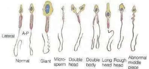 Gambar 3.2. Macam-macam jenis sperma (Sumber: Armatage, 2013)  