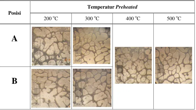 Gambar 4.4 Struktur mikro rheocasting variasi preheated pengaduk dengan  kedalaman pengadukan 30 mm  Temperatur Preheated  Posisi  200  o C  300  o C  400  o C  500  o C  A  B 
