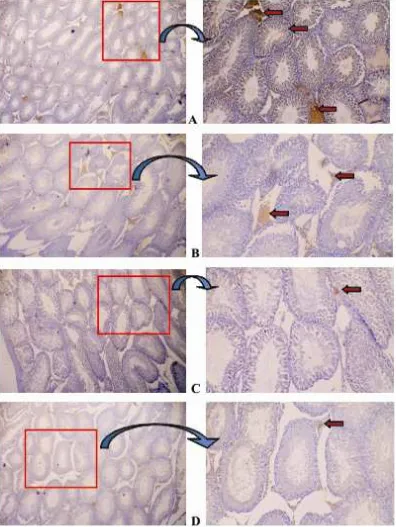 Figure 2. Structure of the testis, IHC staining, magniication with 40x lens (left) and 100x (right).