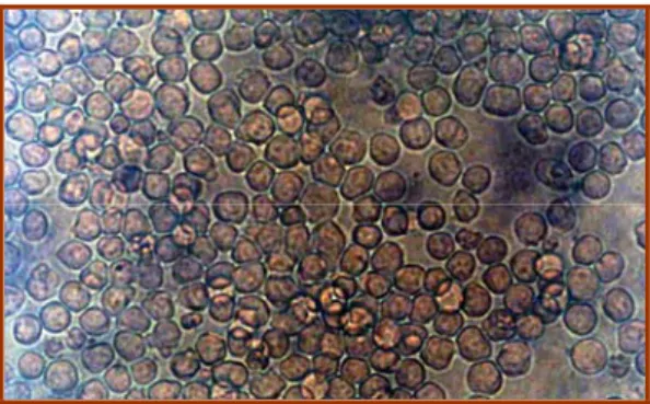Gambar 4. sel mieloma SP2 yang diperbanyak pada medium DMEM.