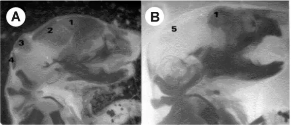 Gambar 2. Fotomikrograf Cranium Fetus: (A) Fetus kelompok kontrol, (B) Fetus kelompok perlakuan AFB 1  dosis  4,5 mg/kg BB