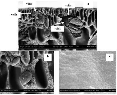 Figure 4. SEM picture of asymmetric uncoated polyimide-zeolite mixed matrix membrane at the: (a, b) cross section and (c) outer surface image layer  