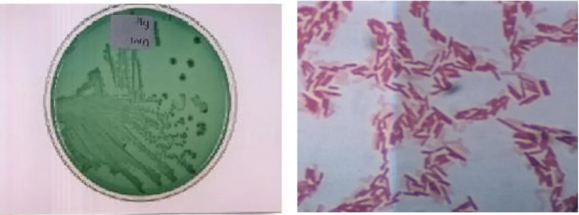 Gambar 1. Gambaran Koloni dan Morfologi Vibrio alginolyticus yang ditanam pada media  padat dengan pengecatan Gram menunjukkan bentuk batang