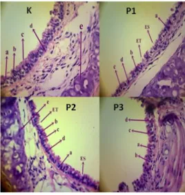 Gambar 3. Fotomikrograf alveolus paru 