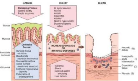 Gambar 3. Patogenesis Ulkus Gaster (Mutmainnah, 2008) 