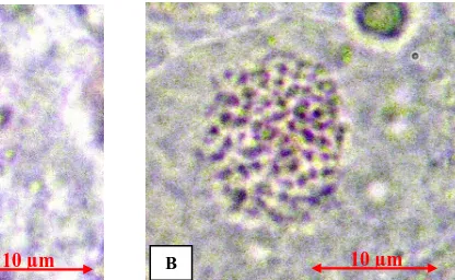 Gambar 2. Kromosom pada sel ujung akar planlet anggrek V. sumatrana Schltr.; A) Kontrol, B)  Hasil perlakuan 0,05% kolkisin selama 24 jam