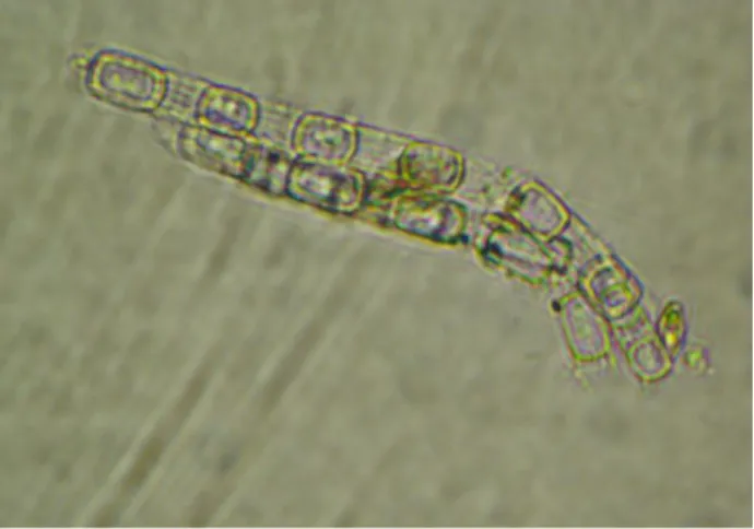Gambar 1. Bentuk sel Skeletonema costatum 