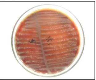 Gambar 2.5   Koloni  Klebsiella  pneumoniae  pada  blood  agar  (Gamma  hemolisis) (Dok) 
