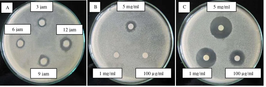 Tabel 3. Daya hambat hasil hidrolisis VCO dan antibiotik terhadap bakteri yang diuji  Zona Hambat (mm) 