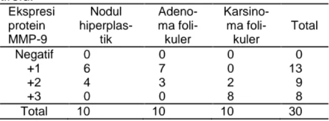 Tabel  3.  Ekspresi  protein  MMP-9  pada  lesi  nodul  tiroid.  Ekspresi  protein  MMP-9  Nodul  hiperplas- tik  Adeno- ma foli-kuler  Karsino- ma foli-kuler  Total  Negatif    0    0    0    0  +1    6    7    0  13  +2    4    3    2    9  +3    0    0 
