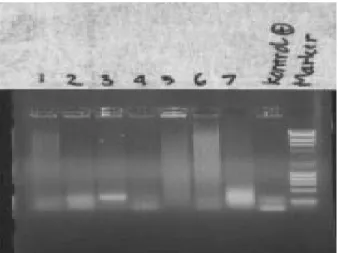 Gambar 1. Hasil Elektroforesis Sampel no  1 (-), 2 (+), 3 (+), 4 (-), 5 (-), 6 (-), 7 (+) 
