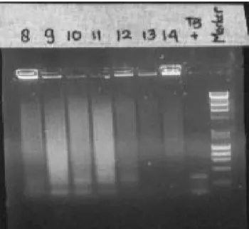 Gambar 2. Hasil Elektroforesis Sampel no  8 (+), 9 (+), 10 (+), 11 (+), 12 (+), 13 (-), 14 (-) 