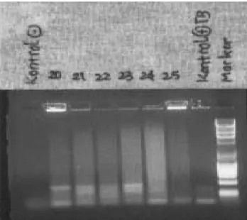 Gambar 4. Hasil Elektroforesis sampel  20 (-), 21 (+), 22 (+), 24 (+), 25 (-) 