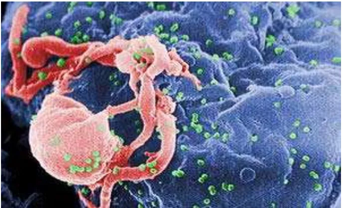 Gambar 2.2.  HIV yang baru memperbanyak diri tampak bermunculan sebagai bulatan-bulatan kecil (diwarnai hijau) pada permukaan limfosit setelah menyerang sel tersebut dilihat dengan mikroskop elektron