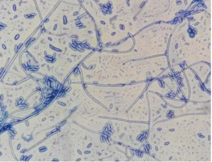Gambar 1. Mikroskopis Fusarium solani 